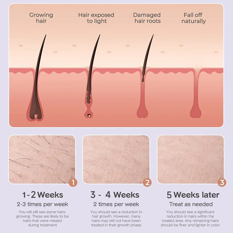 Laser Hair Removal Device - Lipatrend 