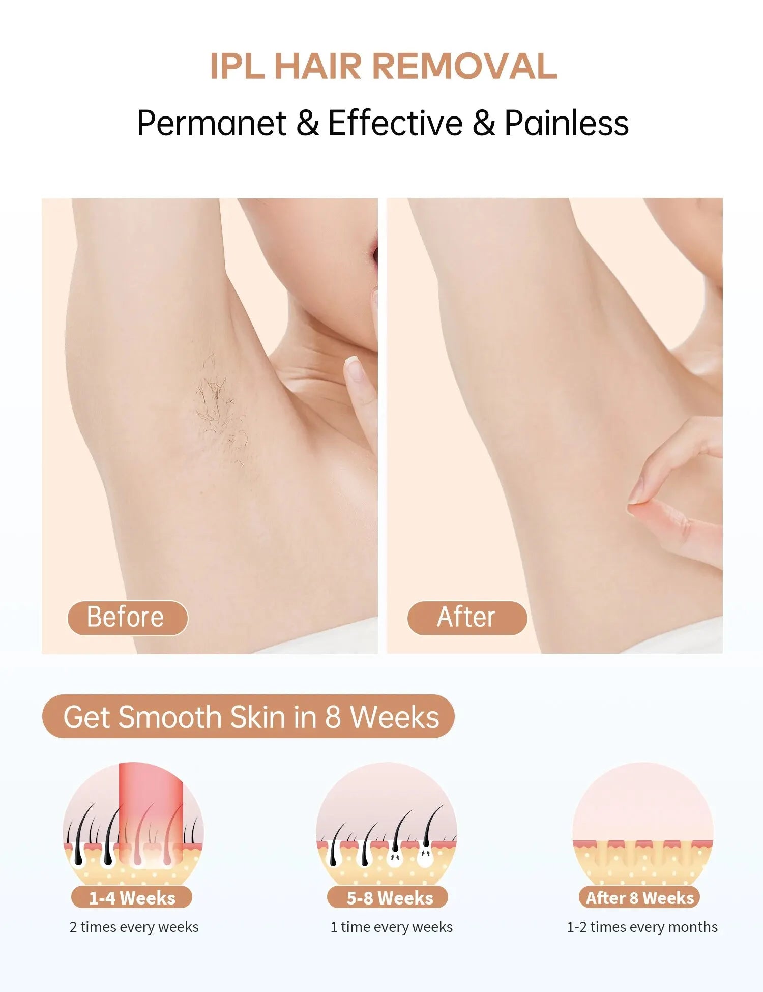 Whole Body Painless Hair Removal - Lipatrend 